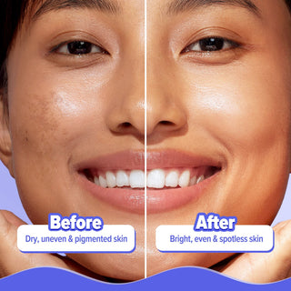 Aqualogica lluminate+ 20x* Alpha Arbutin Luminous Essence Serum_SilkRoutes_5