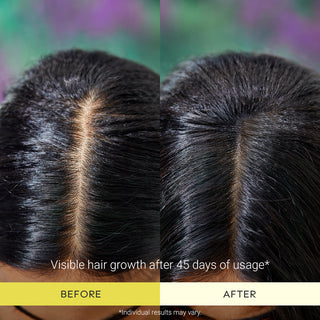 Arata HAIR GROWTH OIL WITH CAPILIA LONGA - 100ML_SilkRoutes_3