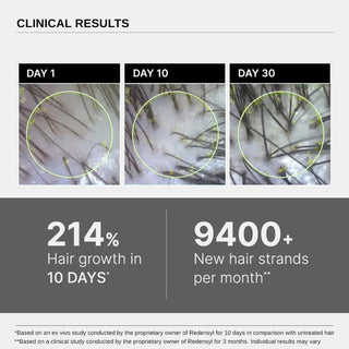 Bare Anatomy Advanced Hair Growth Serum with Redensyl, Rosemary, Rice Water (30 ml) by innovist_SilkRoutes_3