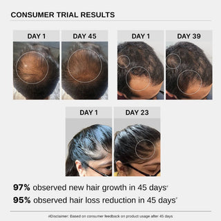 Bare Anatomy Advanced Hair Growth Serum with Redensyl, Rosemary, Rice Water (30 ml) by innovist_SilkRoutes_5