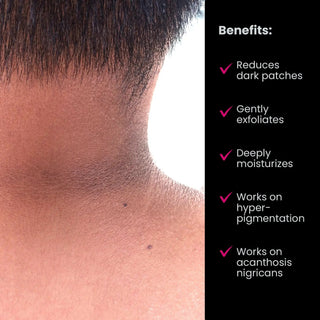 Dark_Patches_Corrector_100ml_silkroutes_3