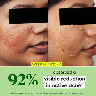 Dot_Key2_Salicylic_ZincSkinClearingFaceSerum_Cica_Cactus__silkroutes_3