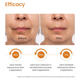 Earth Rhythm CLEAR SKIN SERUM - VITAMIN C, BIO-RETINOL, SALICYLIC ACID & HYALURONIC ACID_SilkRoutes_4