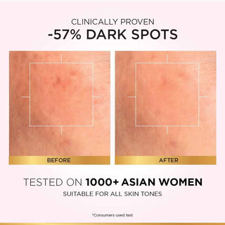 L_OREALPARISGLYCOLICBRIGHTSKINBRIGHTENINGSERUM_15ML_SilkRoutes_4