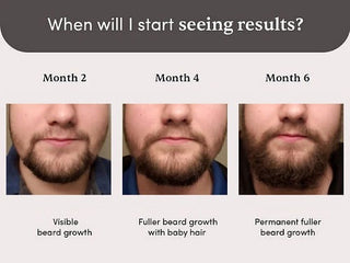 Man Matters Beardmax Growth Serum (30 ml)_SilkRoutes_3