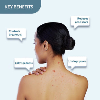 SalyzapBodyWashforBodyAcneSalicylicAcidBodyWash_2_Salicylicacid_1_Azelaicacid_0.1_Teatreeoil_SilkRoutes_3