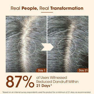 TheAyurvedaCo.MethiHairShampooWithAmlaforHairfallandDandruffControl_SilkRoutes_4