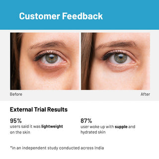 Under_Eye_Cream_for_Dark_Circles_Removal_Wrinkles_Silkroutes_6